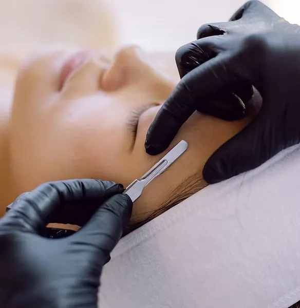 Dermaplaning treatment
