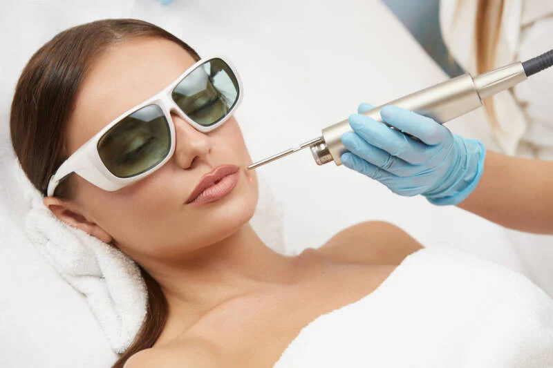 Fotona Laser Therapy